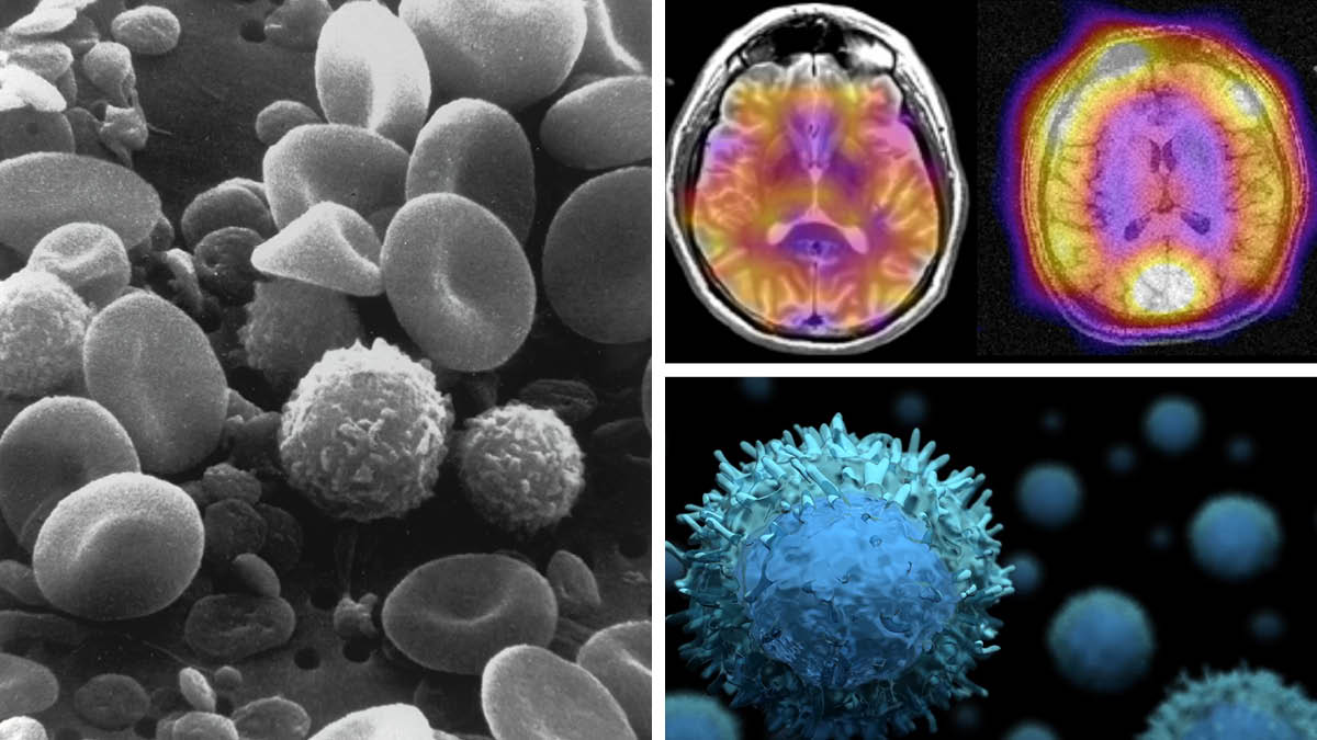 Three-panel collage showing images of blood cells, hyperpolarized C-13 imaging, and an illustration of a T cell