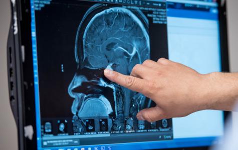 UCSF Brain Tumor Center Online Consult Service