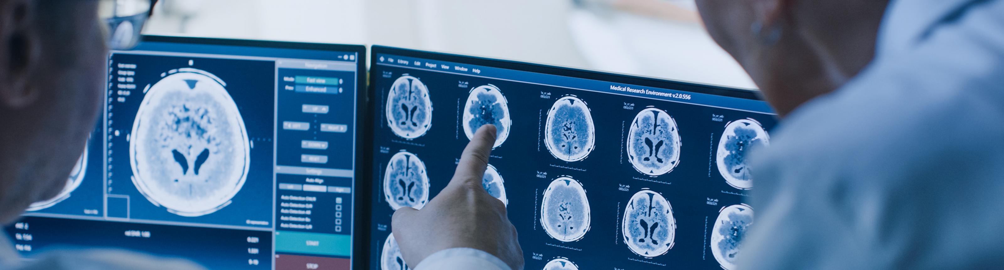 Physicians looking at brain MRI scans