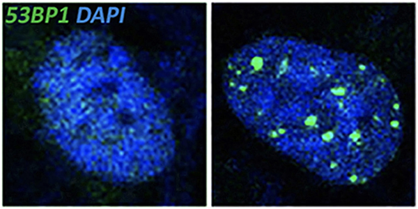 Immunofluorescence images of showing accumulation of double-strand breaks (green) in STAG2-deficient cells (right)" data-align="center" data-caption="DNA double-strand breaks (53BP1, green) accumulate within the nuclei (DAPI, blue) of STAG2-deficient cells (right panel), compared to cells with STAG2 (left panel)