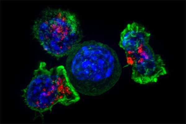 Killer T cells surround cancer cell