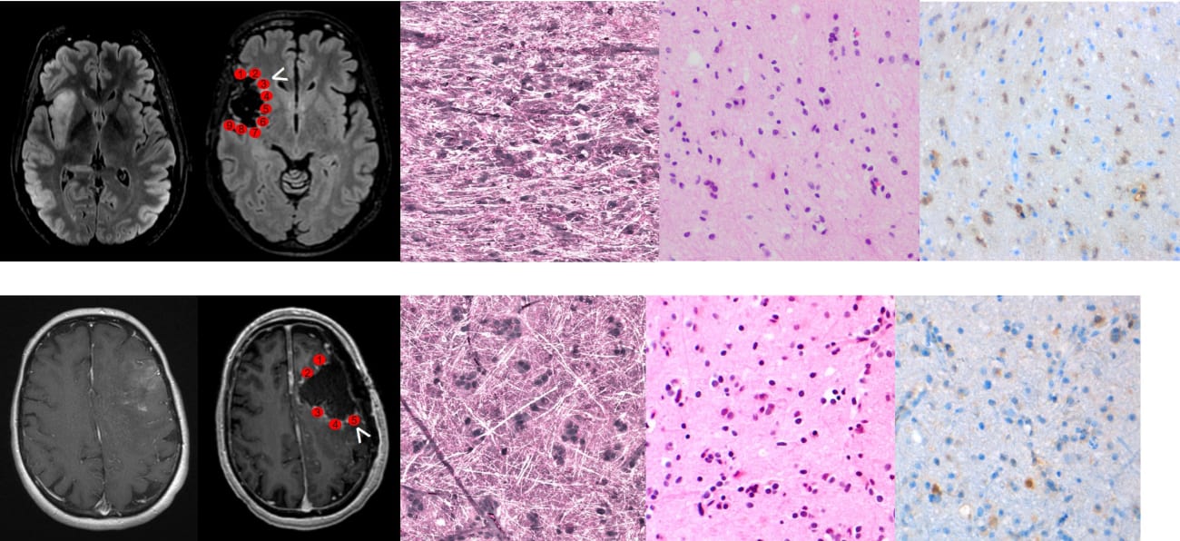 Stimulated Raman Histology