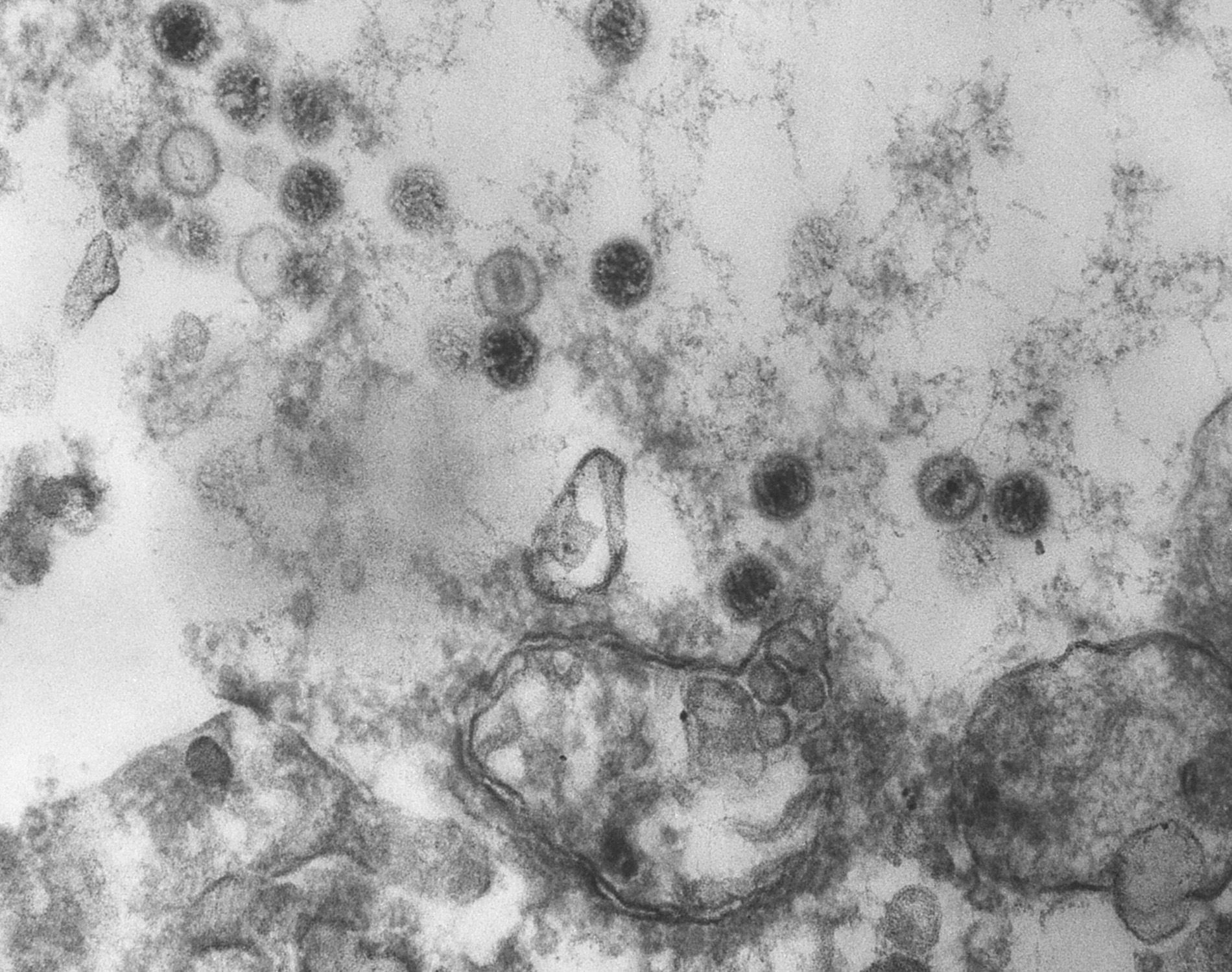 Epstein-Barr virus virions invading cells