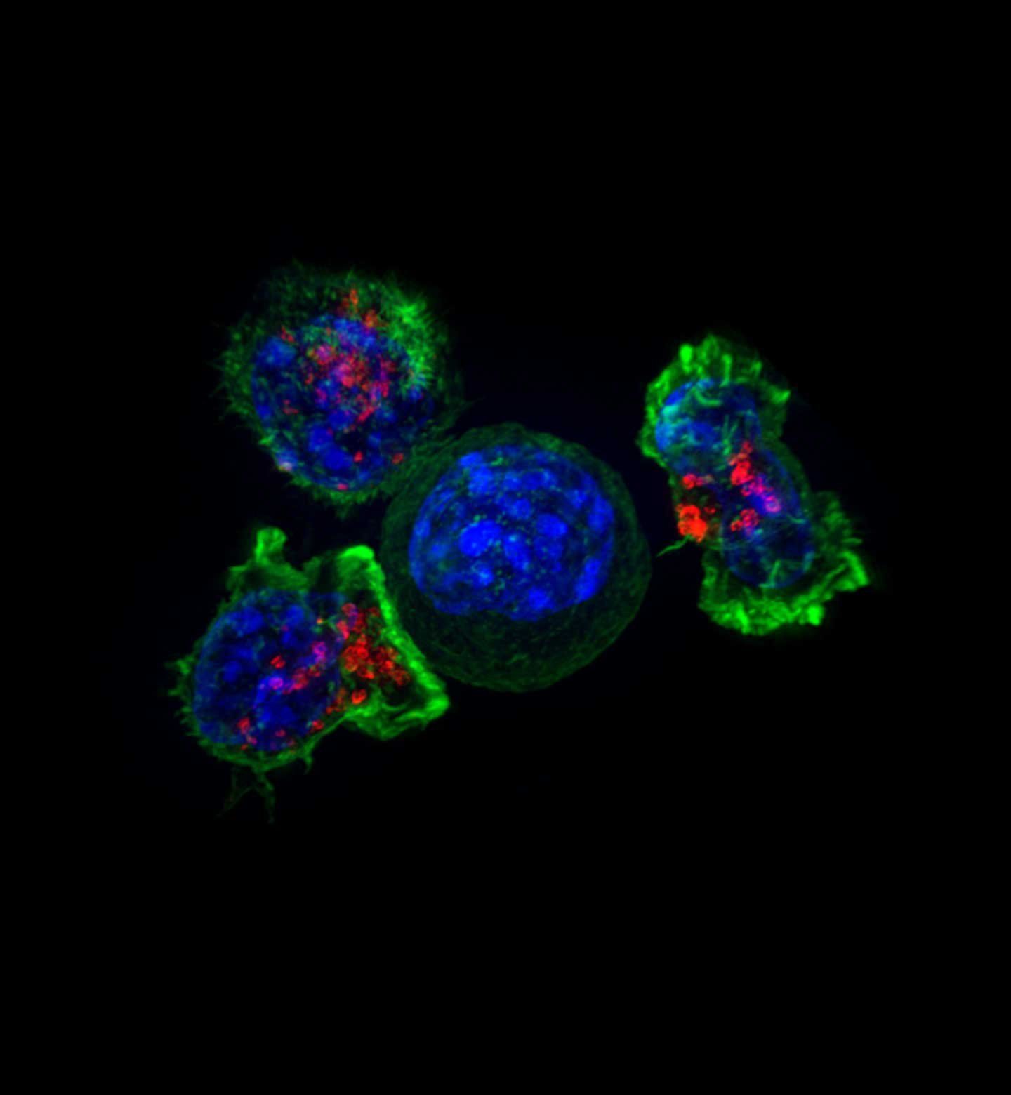 Killer T cells (green and red) surround a cancer cell (blue, center). Credit: NIH