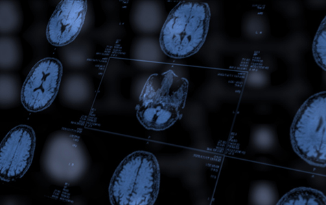 MRI scans of the brain.