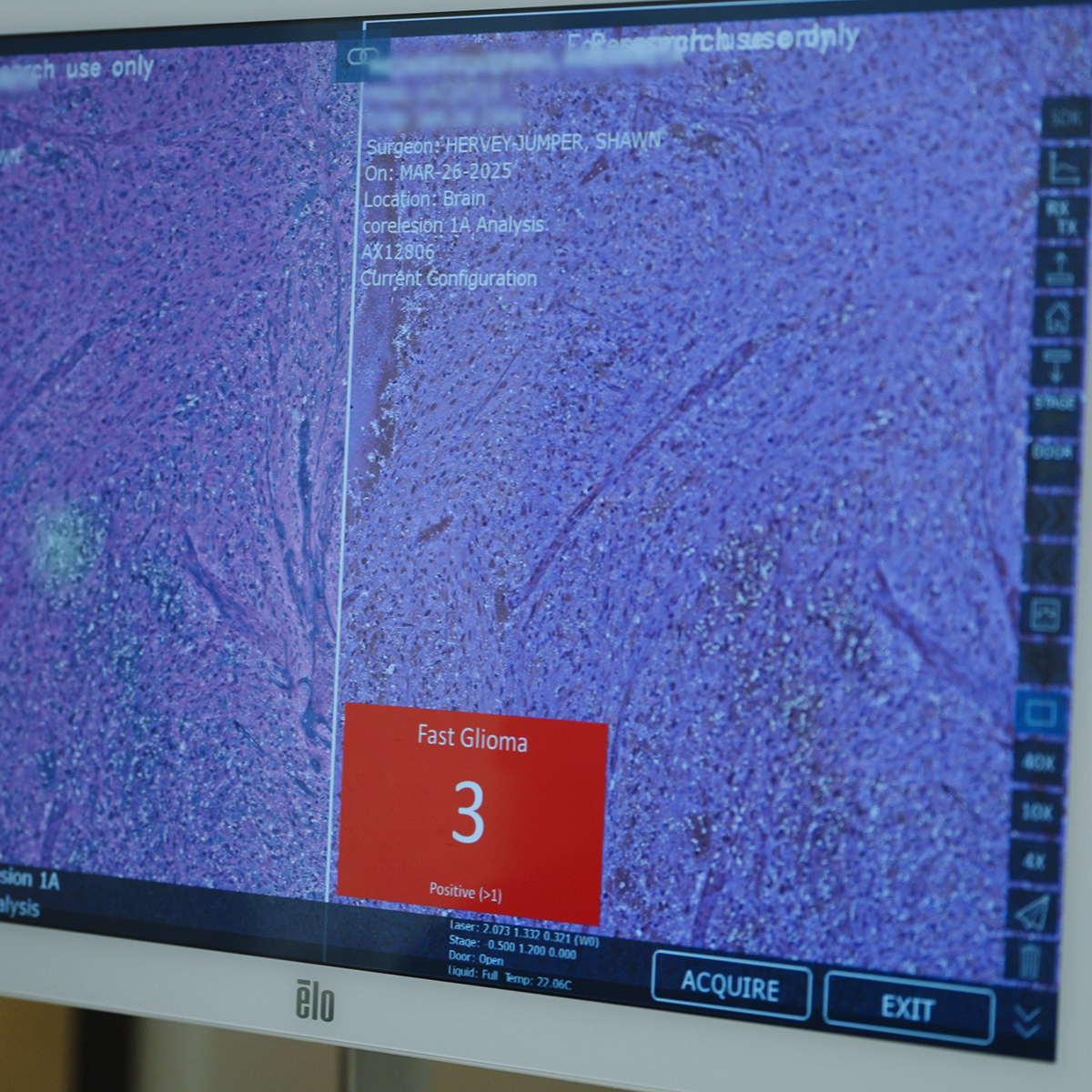 Computer screen showing the FastGlioma readout.