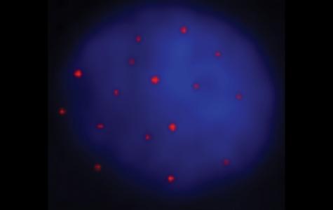 cultured glioma cells analyzed for gamma-H2AX foci (red)