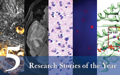 UCSF Brain Tumor Center's Top 5 Research Stories of 2020