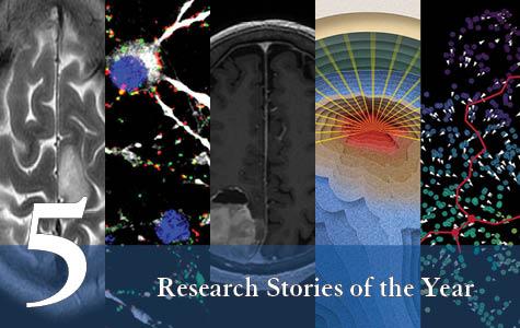 Graphic showing a panel of five images (L to R) MRI showing a glioma; a microscopy image showing connections between glioblastoma cells and brain cells; MRI scan showing a meningioma; an illustration depicting focused ultrasound waves targeting brain tumor; an illustration depicting gene expression analysis. Text banner says 5 Research Stories of the Year.