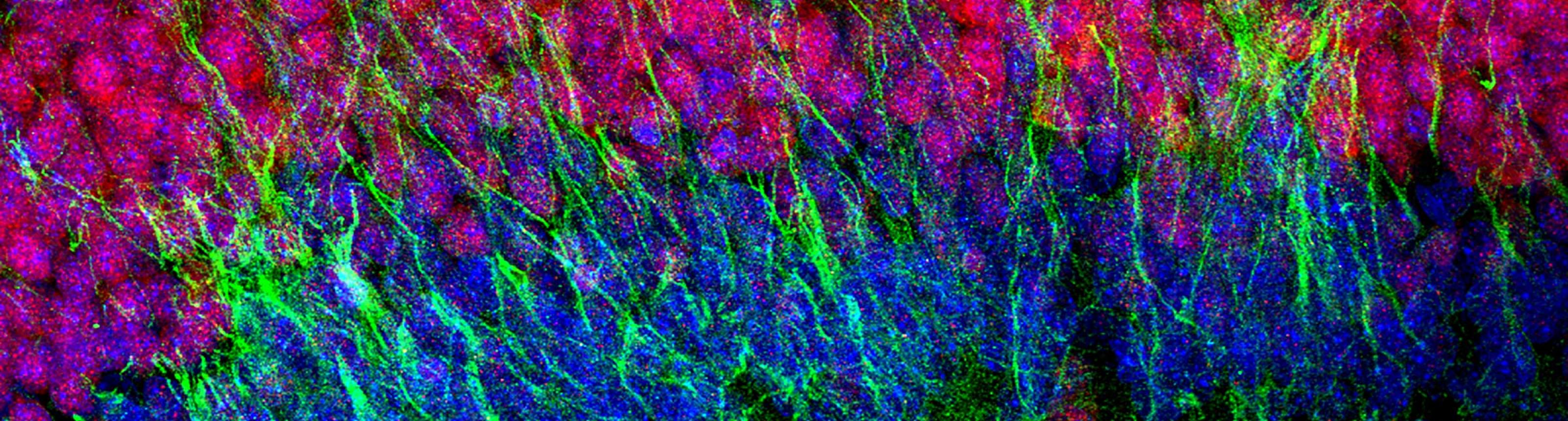Human Neurons at Birth, Alvarez-Buylla Lab