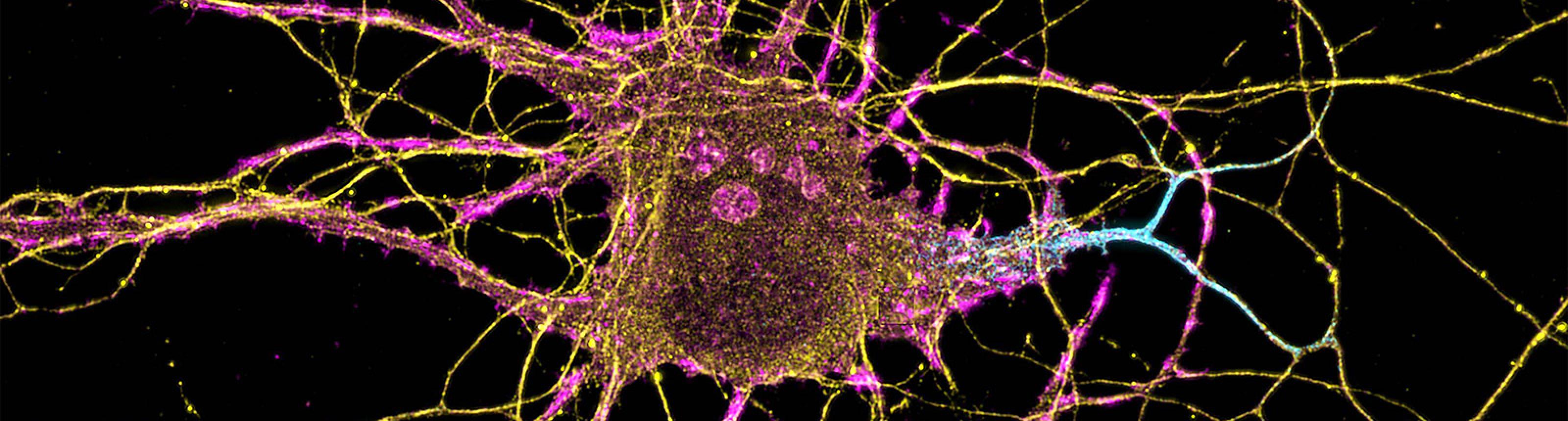 Microscopy image of a neuron. Image credit: Leterrier, NeuroCyto Lab, INP, Marseille, France.