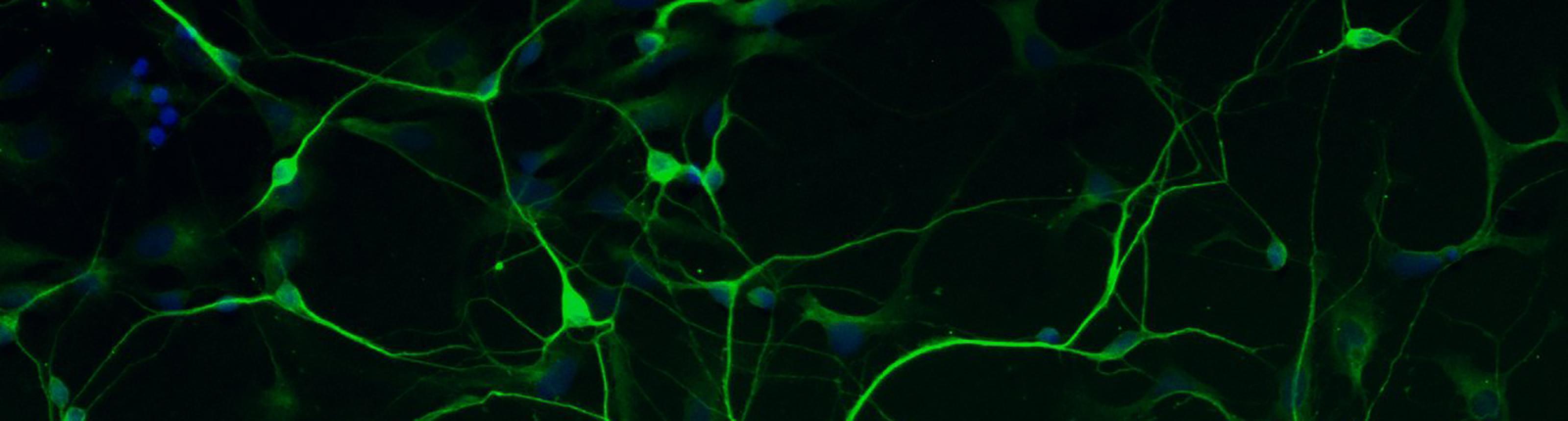 Image of human stem cell derived neuron
