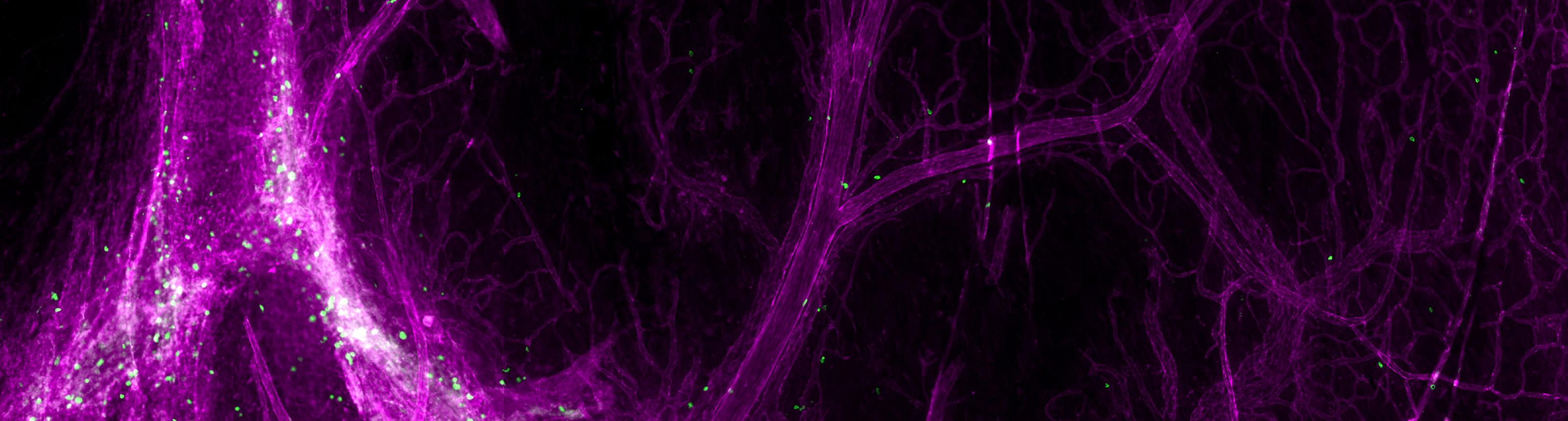 T cells (green) and other leukocytes are found at rest around blood vessels (magenta) within the meningeal membranes surrounding the mouse brain. Photo credit: Jerika Barron.
