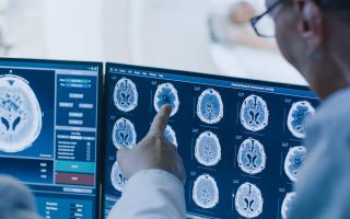 Physicians looking at brain MRI scans